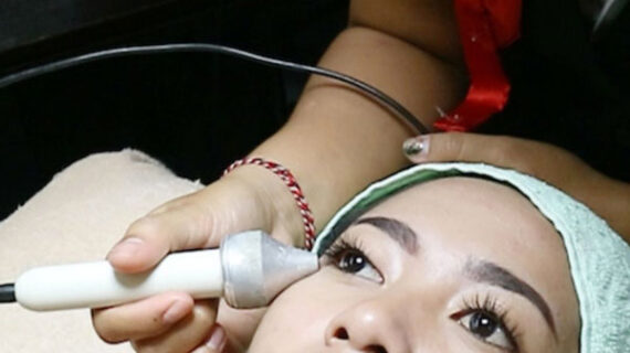 Berapa Lama Proses Lifting Wajah Tanpa Operasi di Denpasar?